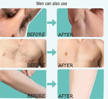 Before and after comparison of men's body hair removal on chest, arm, and neck.