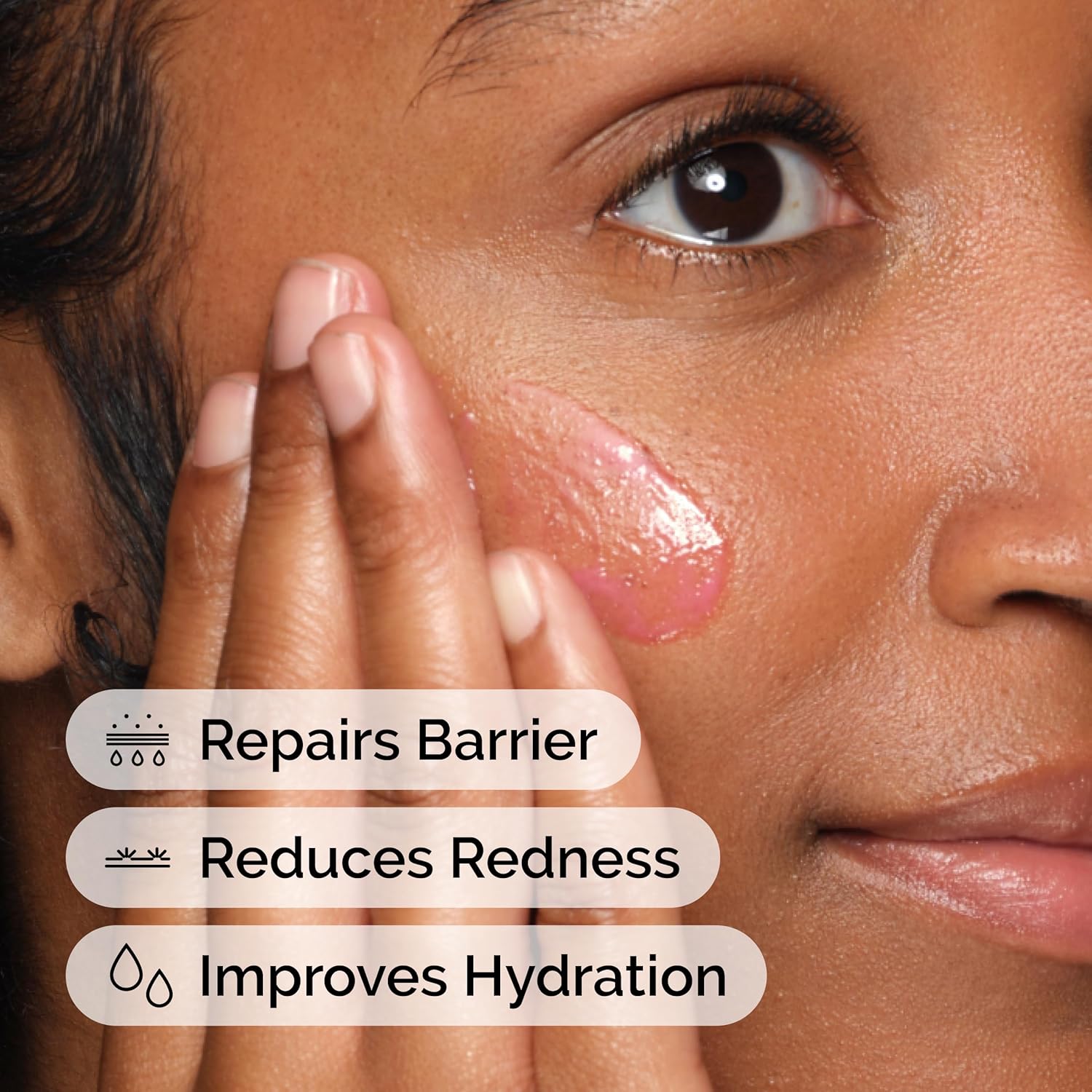 Close-up of a model applying The Ordinary Soothing & Barrier Support Serum to the cheek. The pink serum is shown on the skin, highlighting key benefits including repairing the skin barrier, reducing visible redness, and improving hydration. The image demonstrates the serum’s soothing and restorative properties for sensitive, irritated, and dehydrated skin.