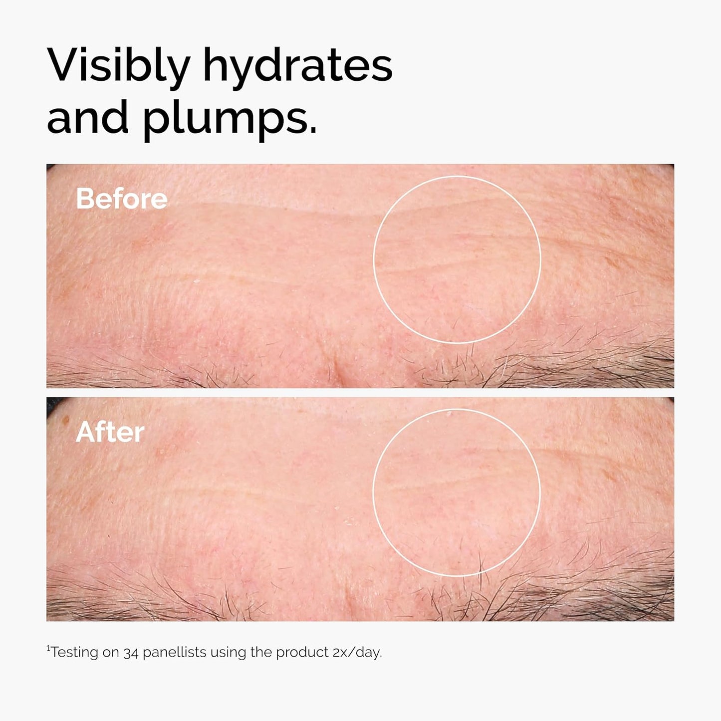 Before and after comparison of hydrated and plumped skin.