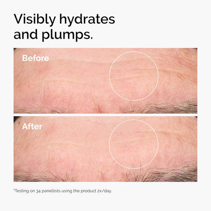 Before and after comparison of hydrated and plumped skin.