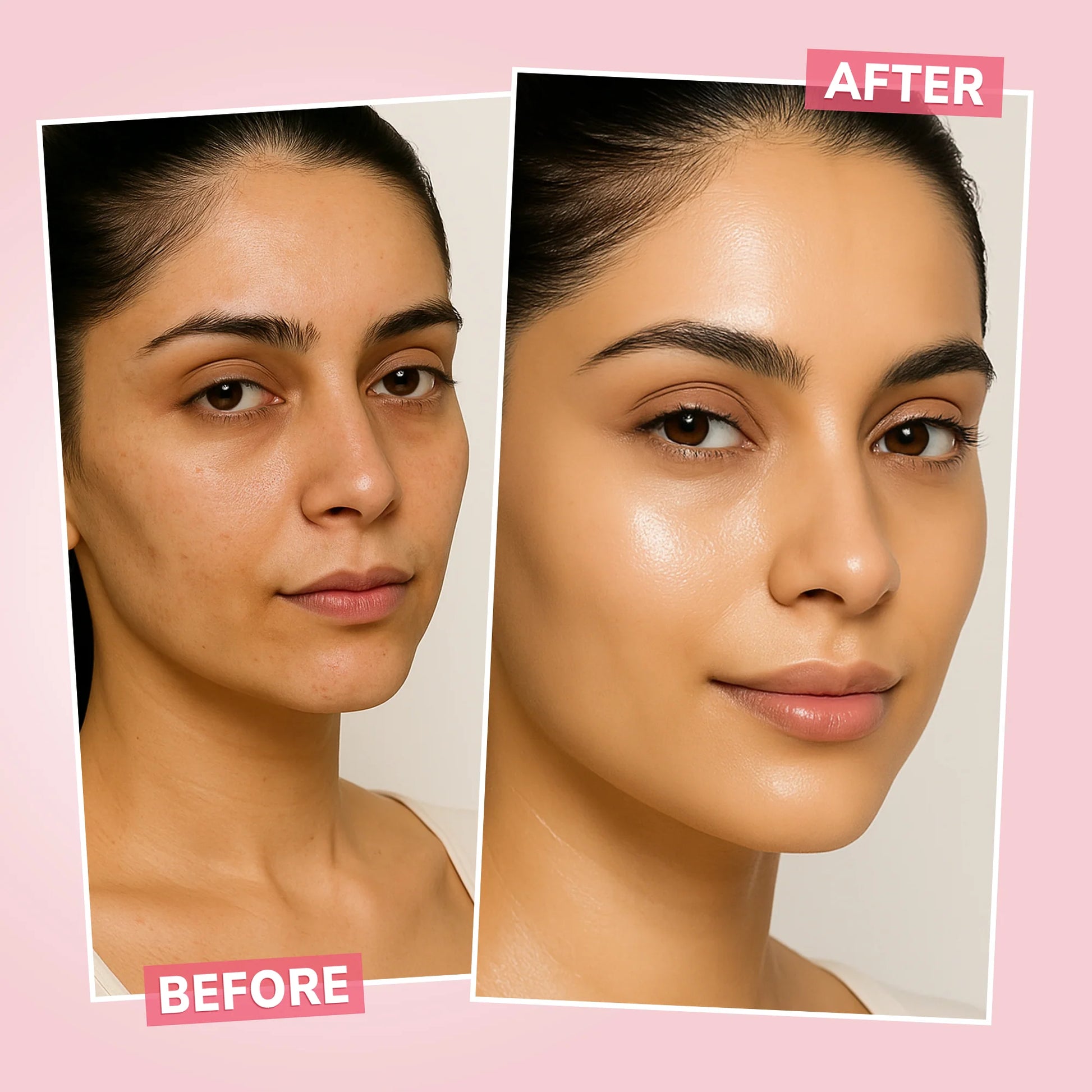 Before and after comparison of a woman's face with skin treatment effects on a pink background.