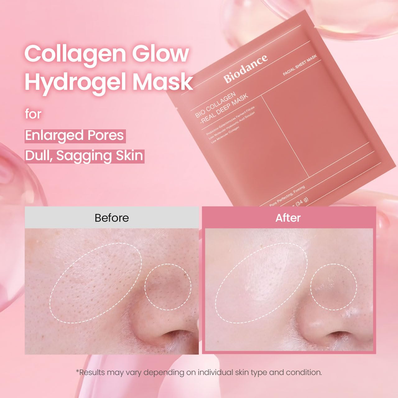 BIODANCE Bio Collagen Real Deep Hydrogel Face Mask showing before and after results for enlarged pores, dull skin and improved skin glow with deep hydration and firming care