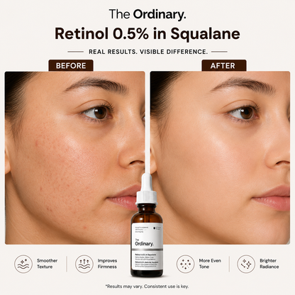 Before-and-after comparison image showcasing the results of The Ordinary Retinol 0.5% in Squalane. The before side shows uneven skin texture and visible pores, while the after side displays smoother-looking skin, improved firmness, a more even skin tone, and enhanced radiance. Product bottle is featured in the center to highlight anti-aging and skin-smoothing benefits. 