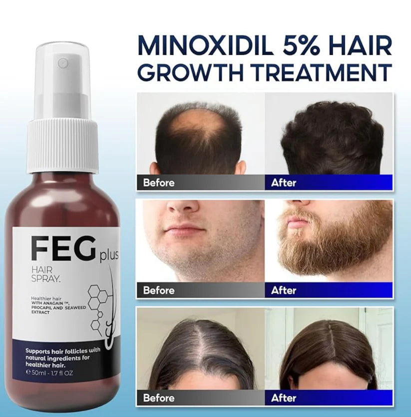 FEG plus hair spray bottle with before and after hair growth treatment images on a blue background