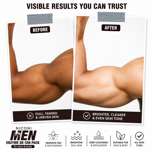 Before-and-after comparison showing the visible effects of Niconi Men Enzyme De-Tan Pack on tanned skin. The "Before" image displays dull, uneven, tanned skin, while the "After" image shows a brighter, clearer, and more even skin tone. The infographic also highlights key benefits including tan removal, brighter skin, deep cleansing and exfoliation, suitability for face and body, and compatibility with all skin types