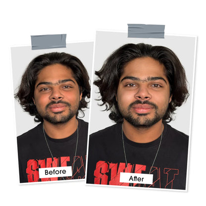 Before and after comparison image showing facial skin results after using Niconi Men Enzyme De-Tan Pack. The image highlights a brighter, more even-looking complexion with reduced dullness and tanning, demonstrating the product's skin-brightening and de-tanning benefits for men.