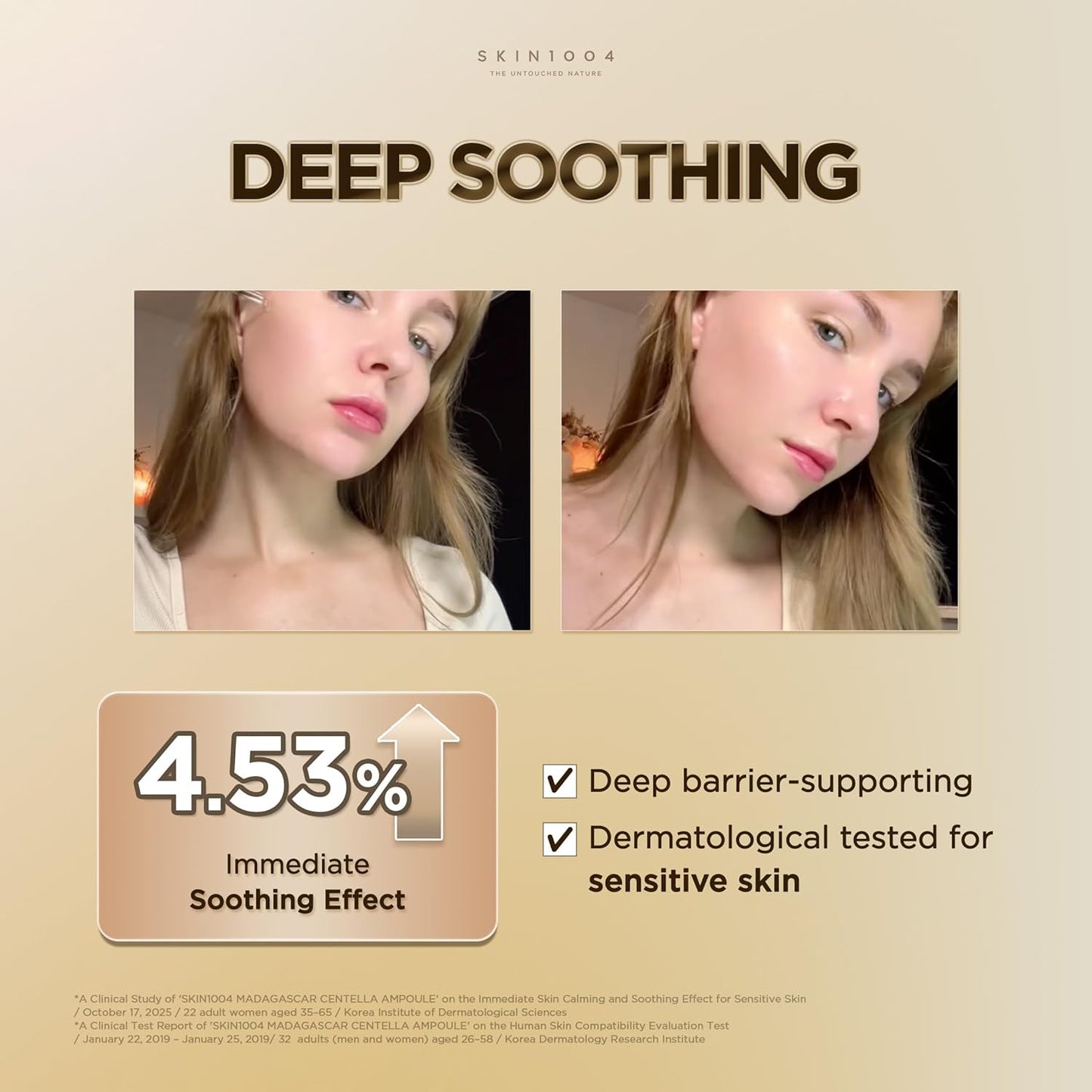 Before-and-after skincare results image highlighting the deep soothing benefits of SKIN1004 Madagascar Centella Ampoule. Shows improved skin calmness and hydration with a 4.53% immediate soothing effect, deep barrier support, and dermatologist-tested care for sensitive skin using Centella Asiatica extract.