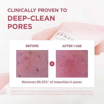 Clinical test results image for SKIN1004 Madagascar Centella Poremizing Deep Cleansing Foam showing before-and-after pore cleansing effectiveness. The comparison demonstrates visible removal of pore impurities after one use, with claims of removing 99.32% of impurities from pores. Highlights the cleanser’s deep-cleansing action with Himalayan Pink Salt and Centella Asiatica for clearer, smoother, and purified skin.