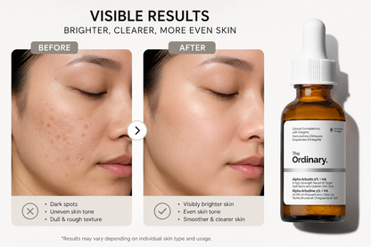 Before and after comparison showing the visible results of The Ordinary Alpha Arbutin 2% + Hyaluronic Acid serum. The image highlights reduced dark spots, a more even skin tone, brighter complexion, and smoother-looking skin, with the product bottle displayed alongside the transformation.