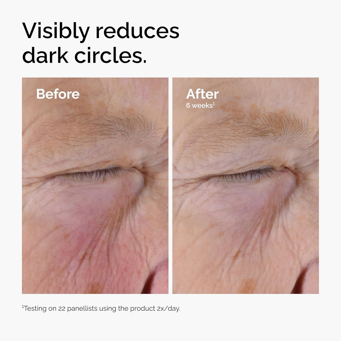 Before-and-after comparison image showing the under-eye area of a mature individual before and after 6 weeks of using The Ordinary Caffeine Solution 5% + EGCG twice daily. The image highlights a visible reduction in the appearance of dark circles and improved brightness around the eye contour. Text notes that results are based on testing with 22 participants.
